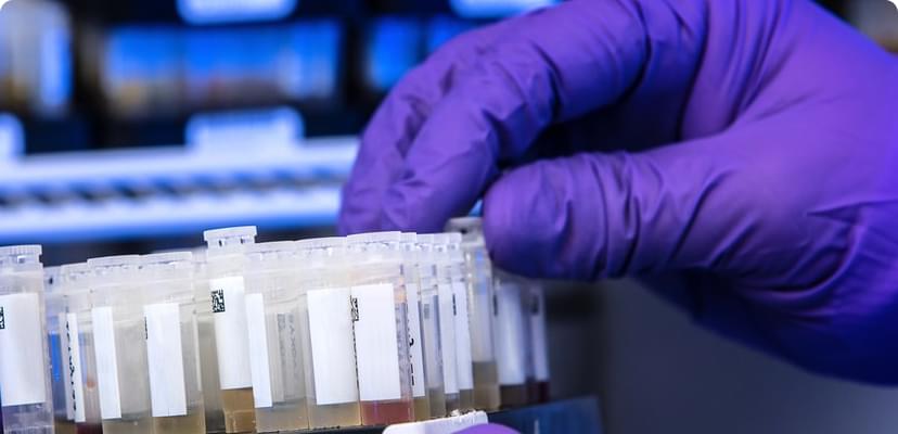 First version of OmicsChart TCGA is now online!