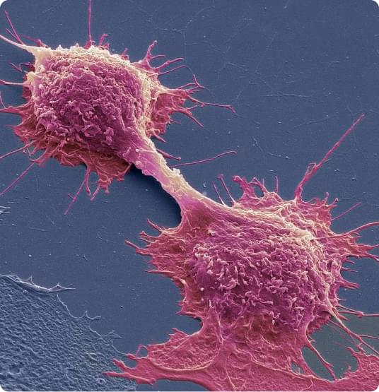 Dividing cancer cells